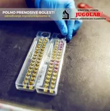 Panel seksualno prenosivih bolesti PCR - 0