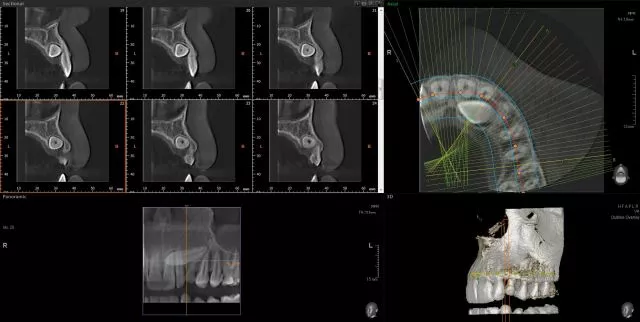 ORTODENT 3D DIGITAL  - 5