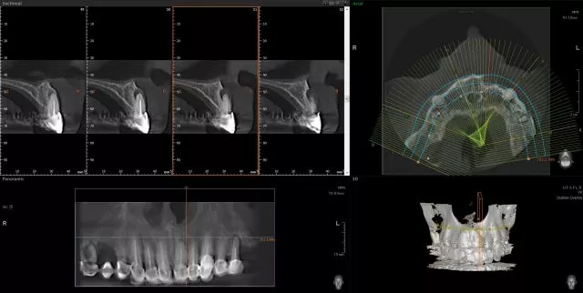 ORTODENT 3D DIGITAL  - 8