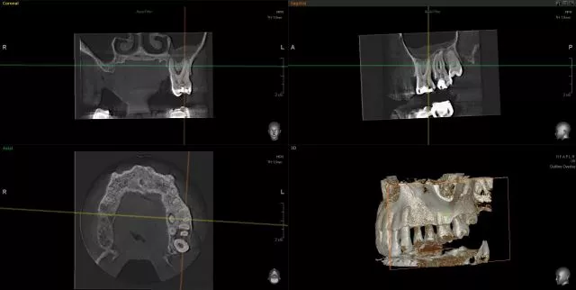 ORTODENT 3D DIGITAL  - 1