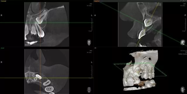 ORTODENT 3D DIGITAL  - 6