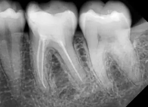 DENTALNI RADIOGRAM - 0